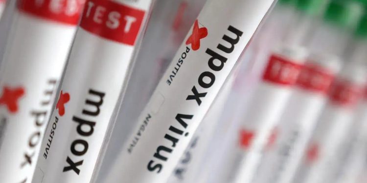 Sobe para 140 número de casos confirmados de Mpox no país, em 2026