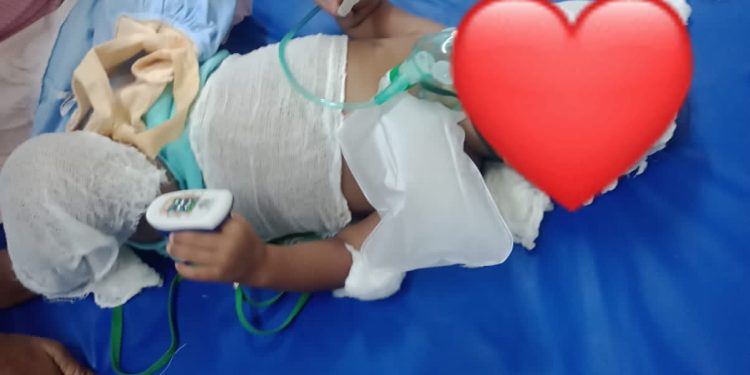 PMs salvam bebê engasgada com leite materno no interior do Amazonas