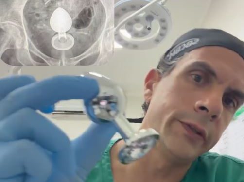 VÍDEO: médico alerta para brincadeiras arriscadas: “amarre seu brinquedinho”