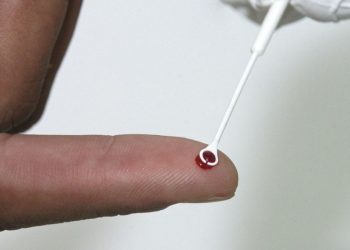 Comissão discute uso de medicamento no SUS para prevenção ao HIV