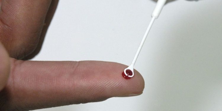 Comissão discute uso de medicamento no SUS para prevenção ao HIV