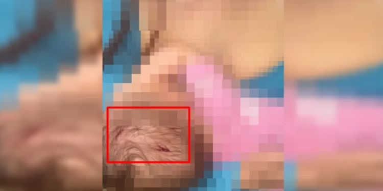 Adolescente tenta agredir mulher e fura cabeça da filha que mamava; VEJA