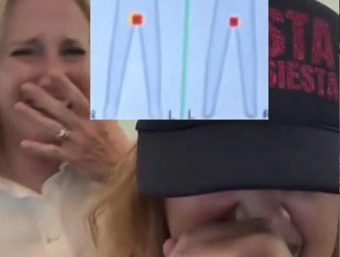 ‘Revista calorosa’: mulher acende raio X de aeroporto com a vagina; VEJA