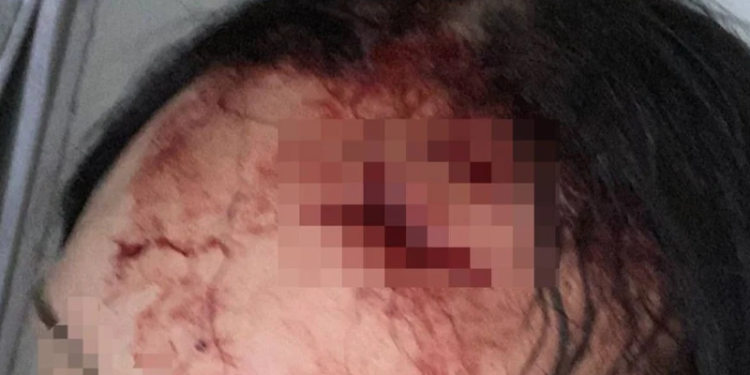 Após levar fora, homem ataca mulher com garrafa de vidro e faca