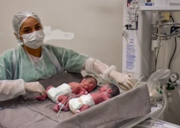 Mãe de seis filhos dá à luz trigêmeos em Manaus